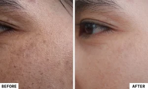 لیزر کیو ندای سلامت