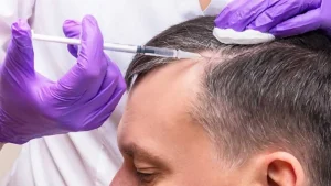 خدمات مزوتراپی و PRP
