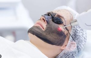 لیزر کیوسوئیچ در ندای سلامت